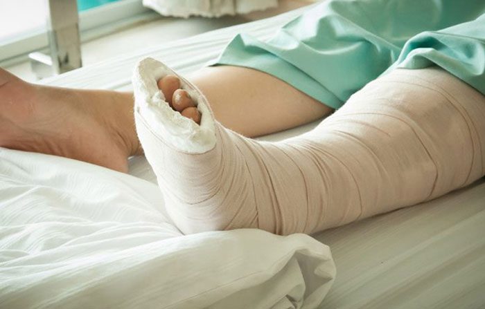 کدام نوع پانسمان مناسب است