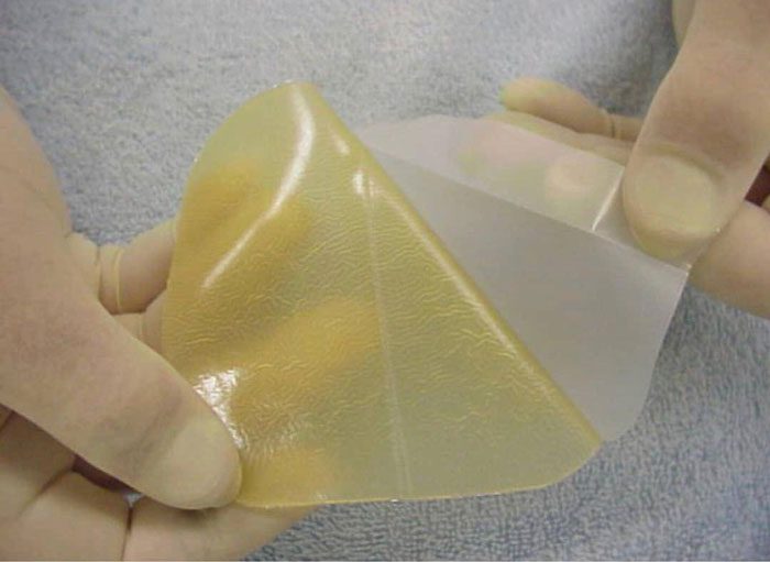 کدام نوع پانسمان مناسب است