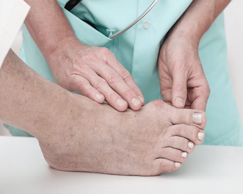 فرآیند فیزیوپاتولوژیک پای دیابتی