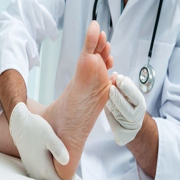 سلامت پا در بیماران دیابتی و عوارض دیابت 1