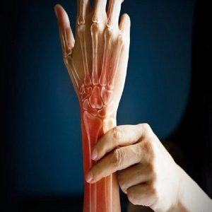 شناخت انواع مختلف زخم و هر آن چیزی که باید آن بدانید 1