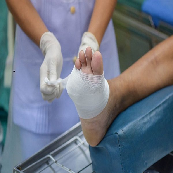 انواع زخم‌های باز و مراقبت‌های پزشکی از آن 1