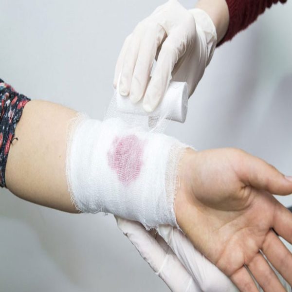 اقدامات اولیه در مراقبت از زخم تروما 1