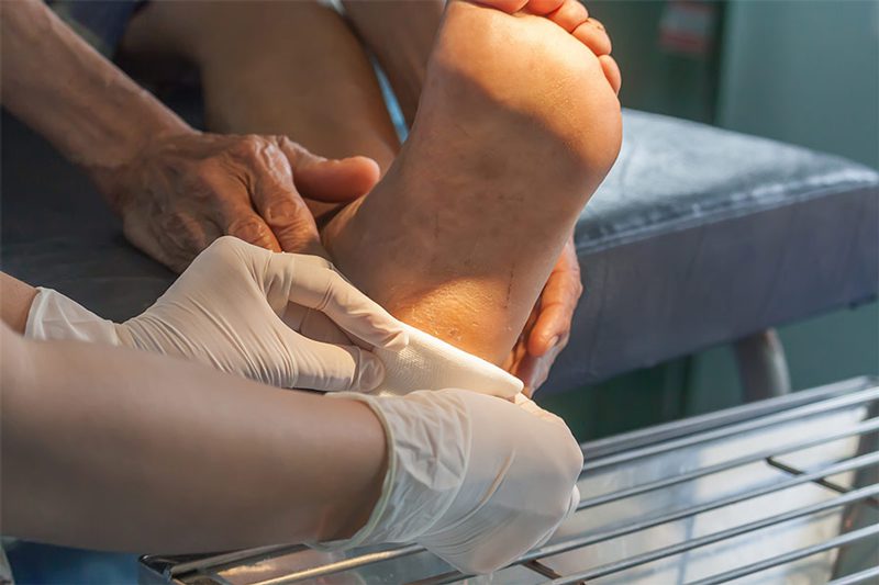 چه عواملی باعث ایجاد پای دیابتی می شود؟