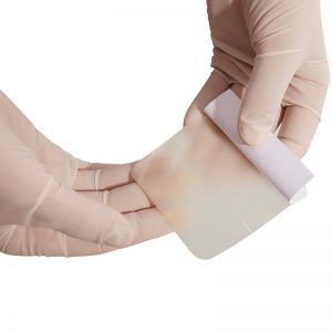 hydrocolloid dressing