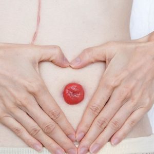 stoma love