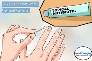 پماد آنتی بیوتیک زخم