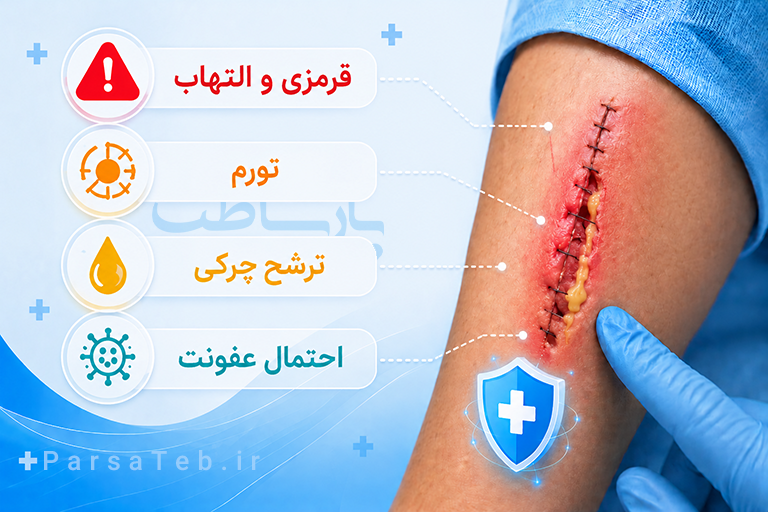 عکس عفونت بخیه- ترشح چرکی از بخیه - باز شدن بخیه بر اثر عفونت