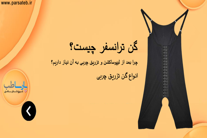 پارساطب گن ترانسفر