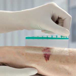 پانسمان آسکینا درم بی بران