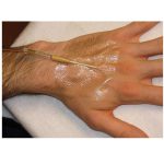 پانسمان هیدروکلوئید فوم دار دودرم سی جی اف کانواتک - Image 4