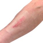 استریل دریپ جراحی IHT - Image 2