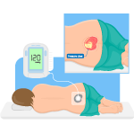 محصولات وکیوم تراپی پارساطب