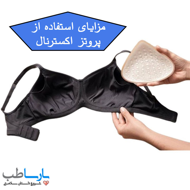 ویژگی ها و مزایای استفاده از پروتز اکسترنال