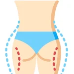 گن لیپوماتیک و لیفت ران و باسن