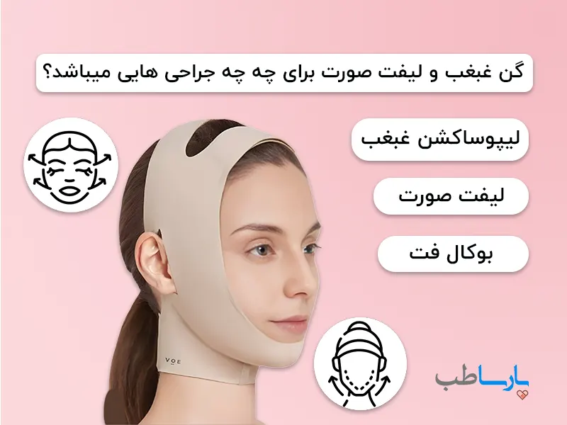 انواع گن لیفت صورت و گن غبغب بر اساس نوع عمل
