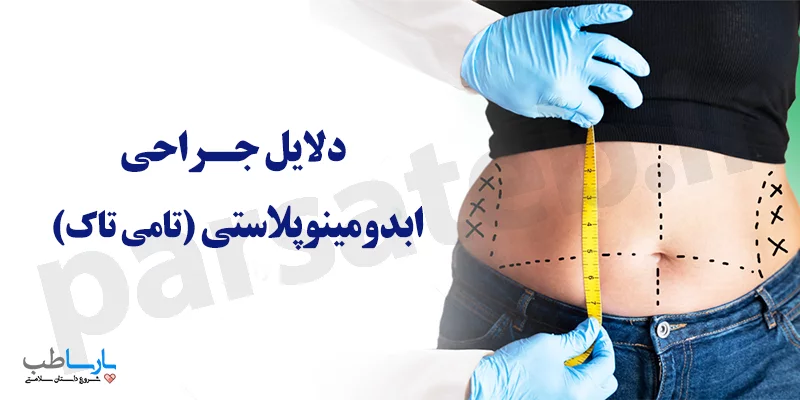 دلایل عمل ابدومینوپلاستی چیست
