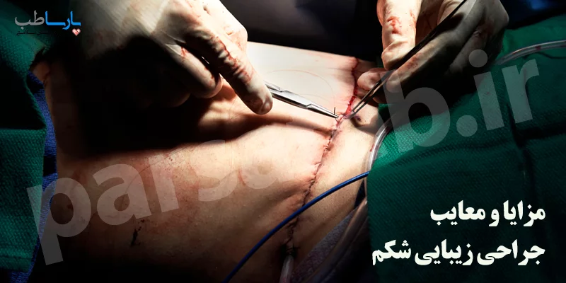مزایا و معایب عمل ابدومینوپلاستی