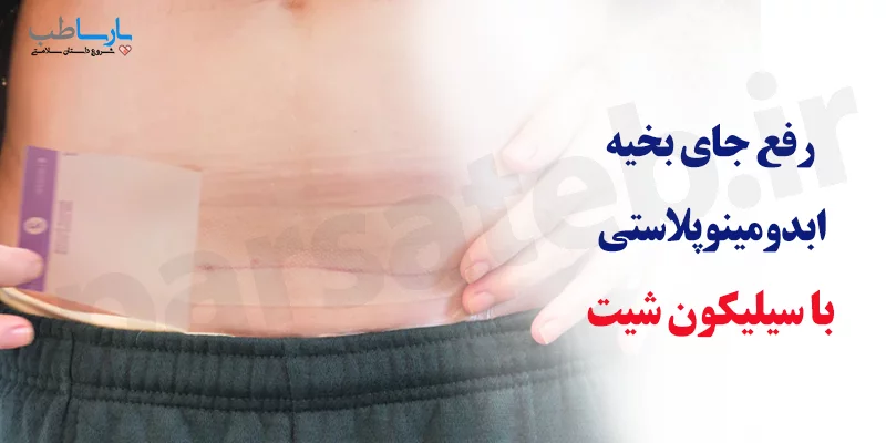 رفع جای بخیه بعد از عمل ابدومینوپلاستی